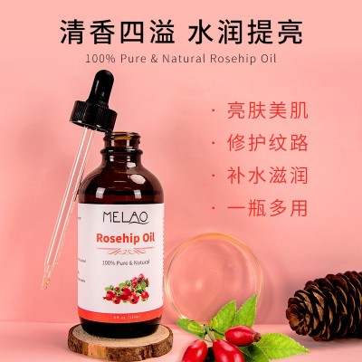 跨境玫瑰果油肩颈按摩精油补水保湿植物护肤身体刮痧推背精油批发  3盒图4